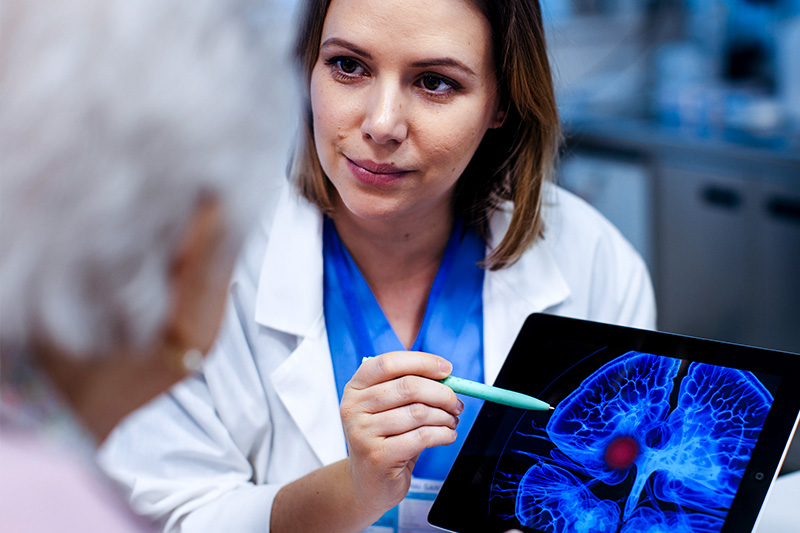 Other Stroke Symptoms to Watch For